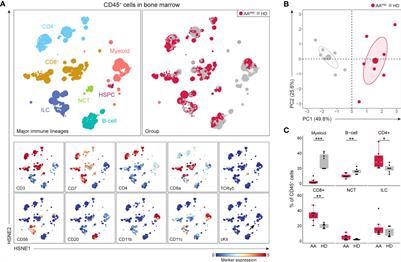 Mass cytometric analysis unveils a disease-specific immune cell network in the bone marrow in acquired aplastic anemia